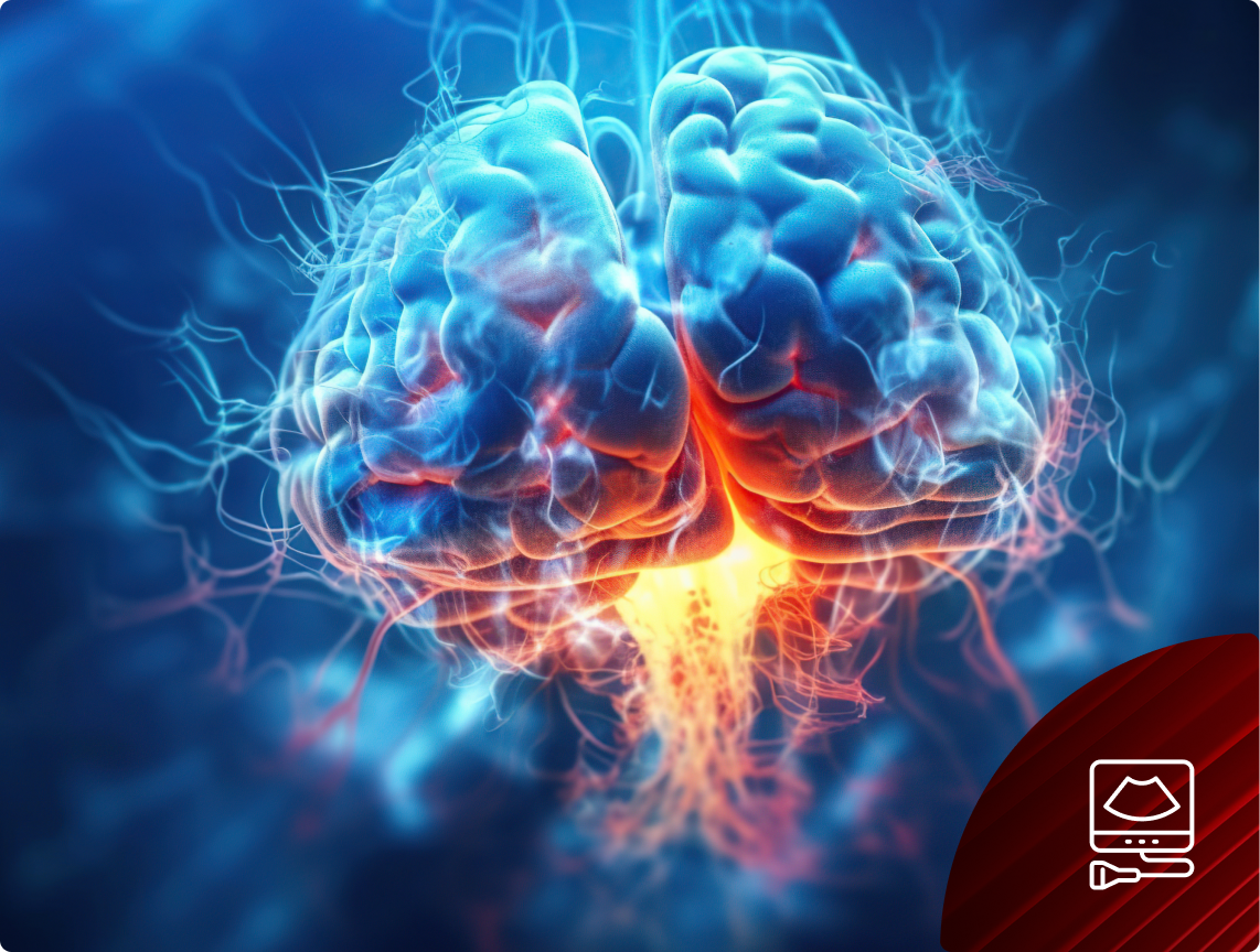 MÓZG - szkolenia kursy TCCD ultrasonografia przezczaszkowa w intensywnej terapii - CriticalUSG